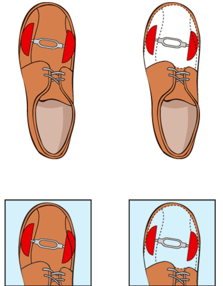 Élargisseur chaussure - la paire (rouge)